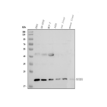 NUCKS1 Rabbit Polyclonal Antibody