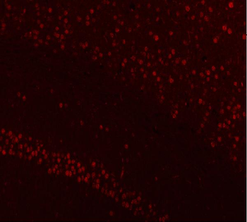 NUCKS1 Rabbit Polyclonal Antibody