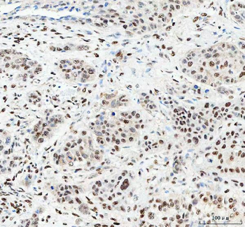 NUCKS1 Rabbit Polyclonal Antibody