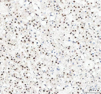 NUCKS1 Rabbit Polyclonal Antibody