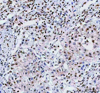 NUCKS1 Rabbit Polyclonal Antibody