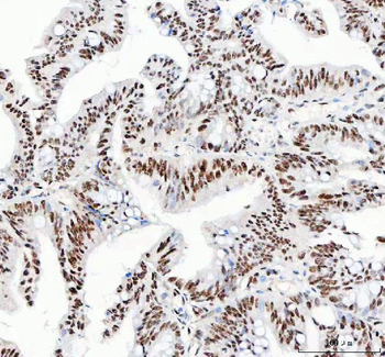 NUCKS1 Rabbit Polyclonal Antibody