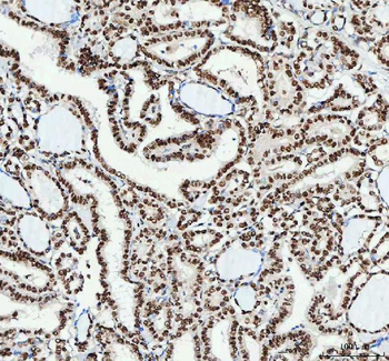 NUCKS1 Rabbit Polyclonal Antibody