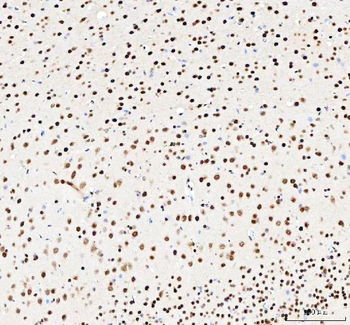 NUCKS1 Rabbit Polyclonal Antibody