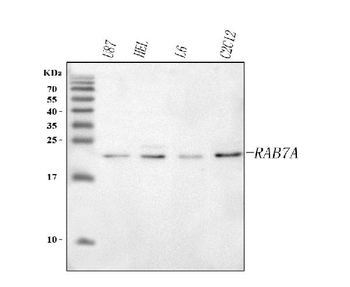 RAB7A Rabbit Polyclonal Antibody