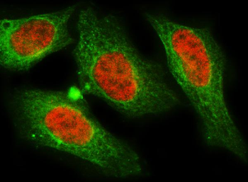 MNAT1 Rabbit Polyclonal Antibody