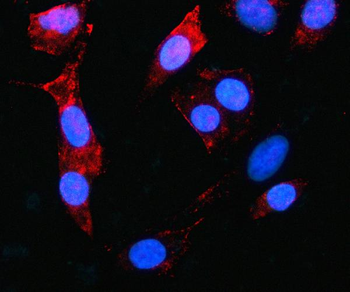 MAGED4 Rabbit Polyclonal Antibody