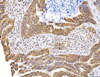 MAGED4 Rabbit Polyclonal Antibody