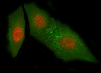 NUB1 Rabbit Polyclonal Antibody