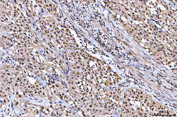 NUB1 Rabbit Polyclonal Antibody