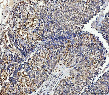 NUB1 Rabbit Polyclonal Antibody