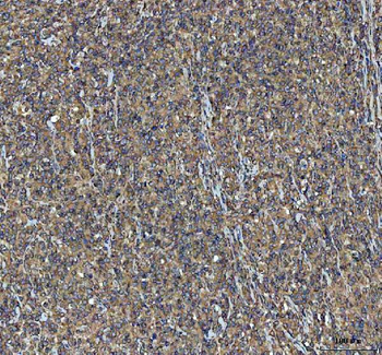 NSG1 Rabbit Polyclonal Antibody