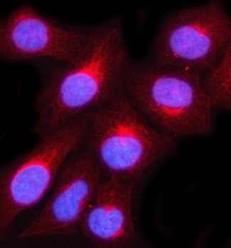 MUC3A/B Rabbit Polyclonal Antibody