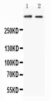 Huntingtin/HTT Rabbit Polyclonal Antibody