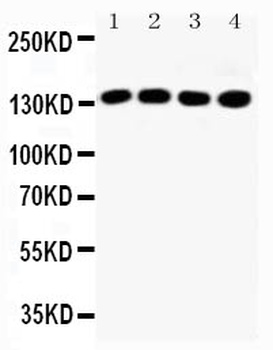 Insulin receptor substrate 1 IRS1 Rabbit Polyclonal Antibody