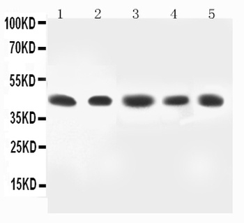 MEK4/MAP2K4 Rabbit Polyclonal Antibody