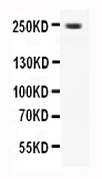 CaV1.3/CACNA1D Rabbit Polyclonal Antibody