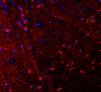 PSD95/DLG4 Rabbit Polyclonal Antibody