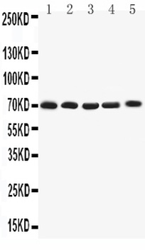 Kv1.4/KCNA4 Rabbit Polyclonal Antibody