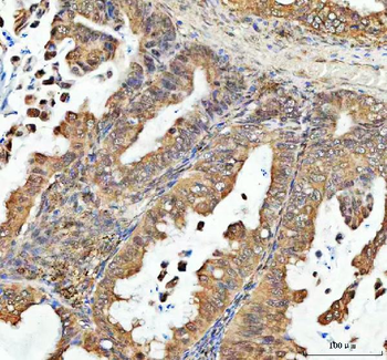 PSIP1 Rabbit Polyclonal Antibody