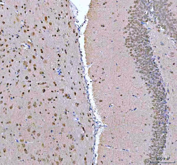 PSIP1 Rabbit Polyclonal Antibody