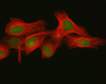 FBXO32 Rabbit Polyclonal Antibody