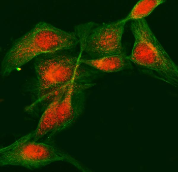 LDOC1 Rabbit Polyclonal Antibody