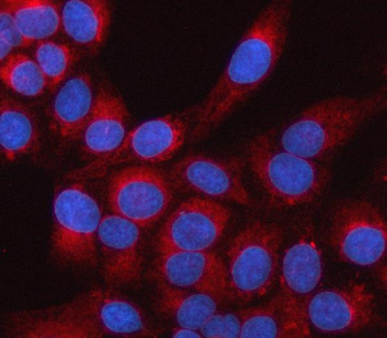 LRRC59 Rabbit Polyclonal Antibody