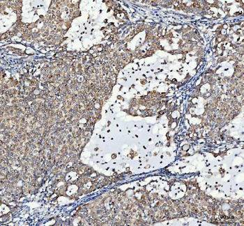 LRRC59 Rabbit Polyclonal Antibody
