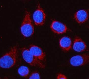LGI4 Rabbit Polyclonal Antibody