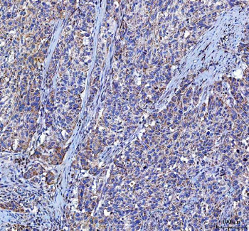 LGI4 Rabbit Polyclonal Antibody