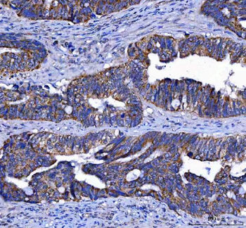 LGI4 Rabbit Polyclonal Antibody