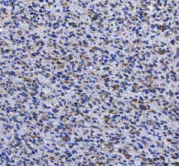 LGI4 Rabbit Polyclonal Antibody