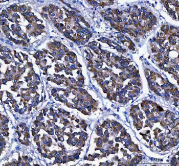 LGI4 Rabbit Polyclonal Antibody