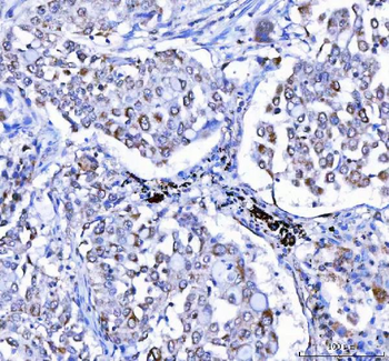 LGI4 Rabbit Polyclonal Antibody