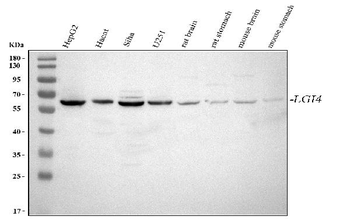 LGI4 Rabbit Polyclonal Antibody