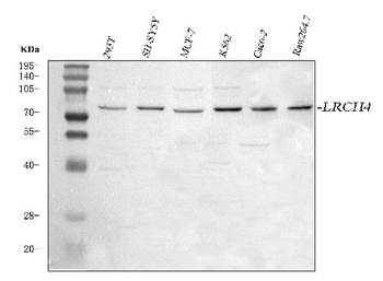 LRCH4 Rabbit Polyclonal Antibody