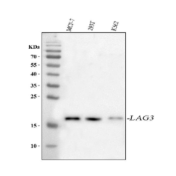 LAGE3 Rabbit Polyclonal Antibody