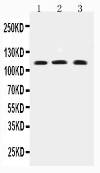 TRPC4 Rabbit Polyclonal Antibody