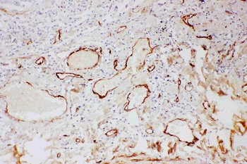 Adiponectin/ADIPOQ Rabbit Polyclonal Antibody