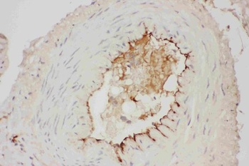 Adiponectin/ADIPOQ Rabbit Polyclonal Antibody