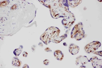 Adiponectin/ADIPOQ Rabbit Polyclonal Antibody