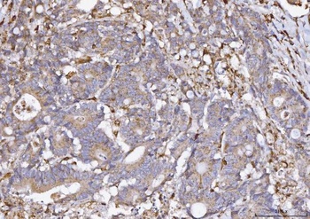 COX1/Cyclooxygenase 1/PTGS1 Rabbit Polyclonal Antibody