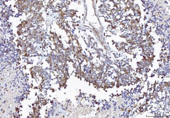 COX1/Cyclooxygenase 1/PTGS1 Rabbit Polyclonal Antibody