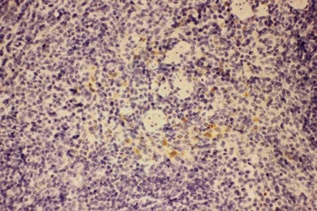 GM-CSF/CSF2/GM Rabbit Polyclonal Antibody
