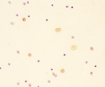 IL18 Rabbit Polyclonal Antibody