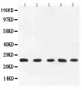 TNF alpha Rabbit Polyclonal Antibody