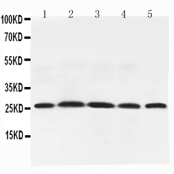 Adiponectin/ADIPOQ Rabbit Polyclonal Antibody