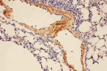 Adiponectin/ADIPOQ Rabbit Polyclonal Antibody