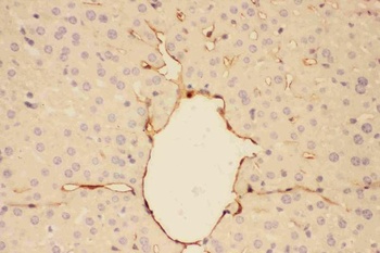 Adiponectin/ADIPOQ Rabbit Polyclonal Antibody